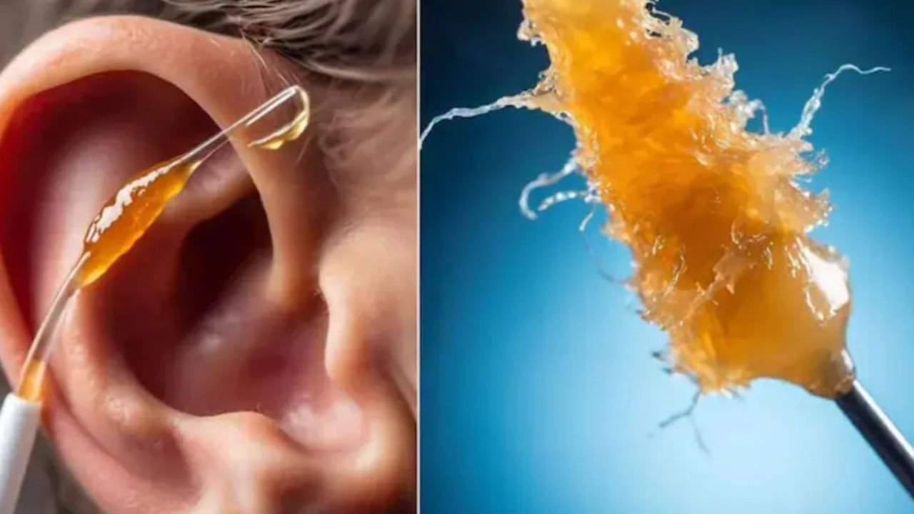 Ear Wax Removal