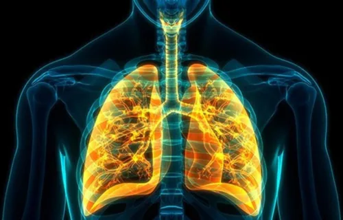 Lung Tumor