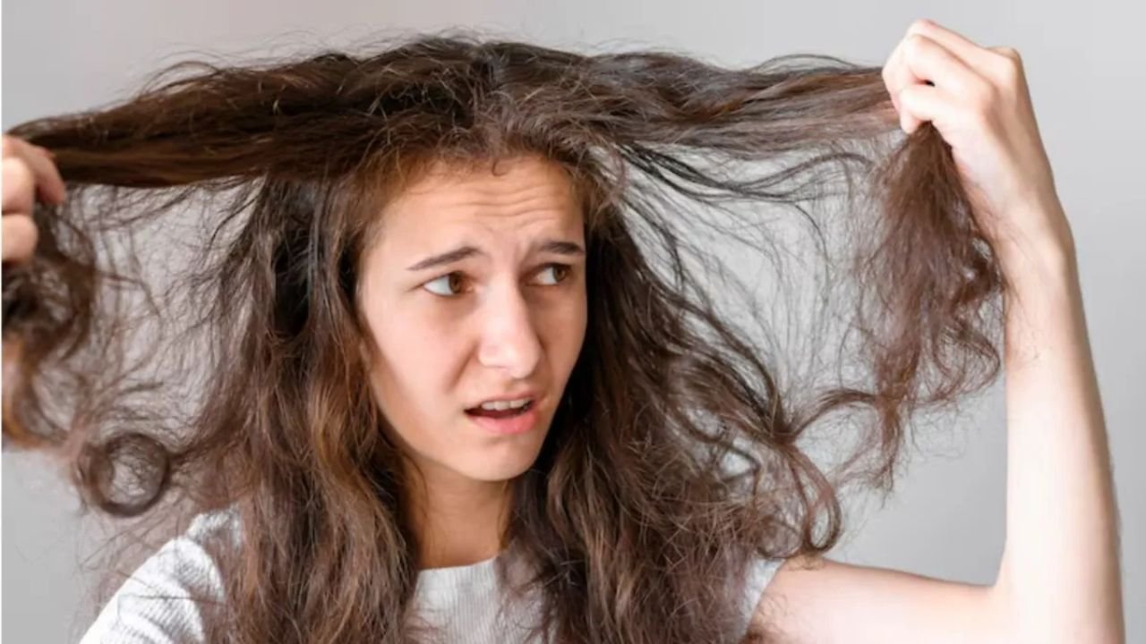 Monsoon Hairfall Problem