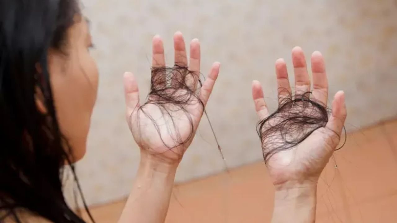 Monsoon Hairfall Problem